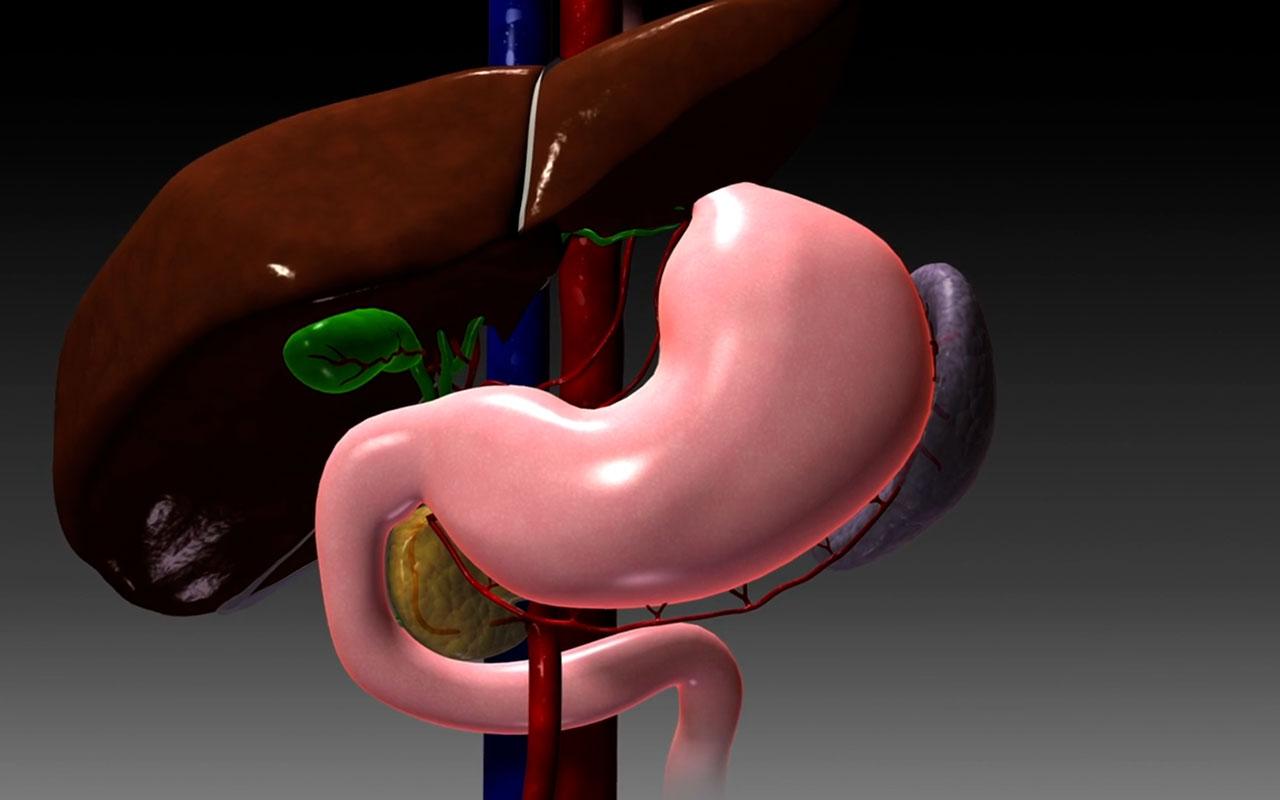 Tüp Mide Ameliyatı Öncesi Mide