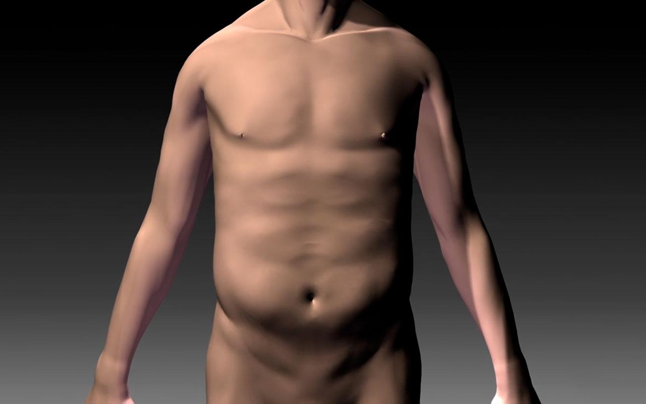 Tüp Mide Ameliyatı Sonrası Vücut Görünümü